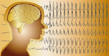 Colaboração para o desenvolvimento e comercialização de novas terapêuticas biológicas para a epilepsia