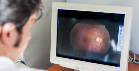 Estudo destaca retina como possível biomarcador precoce da doença de Parkinson