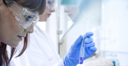 Investigadores desvendam papel de proteína que ajuda a perceber doenças neurodegenerativas