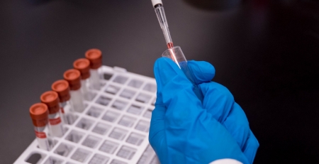 Santa Casa distingue investigações sobre Parkinson e medula espinhal