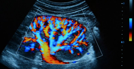 Exame simples deteta alterações cerebrais em doentes com enxaquecas crónicas