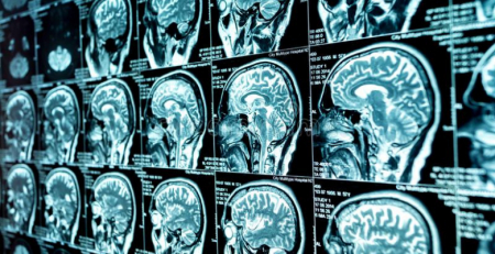 Ordem dos Médicos do Norte distingue estudo sobre tratamento de glioblastoma