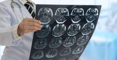 Alnylam apresenta resultados positivos com vutrisiran em doentes com amiloidose ATTRh com polineuropatia