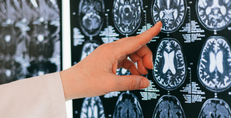 IPS integra projeto europeu de soluções tecnológicas para apoiar cuidadores de doentes com Alzheimer