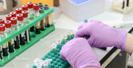 Investigadores descobrem molécula que pode travar a doença de Alzheimer