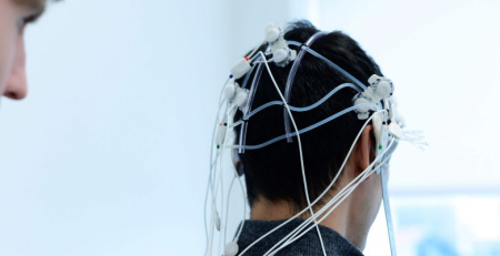 CHUC inicia tratamento cerebral pioneiro de estimulação magnética transcraniana