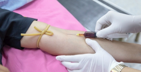 Análise ao sangue deteta sinais da doença de Alzheimer antes de os sintomas surgirem